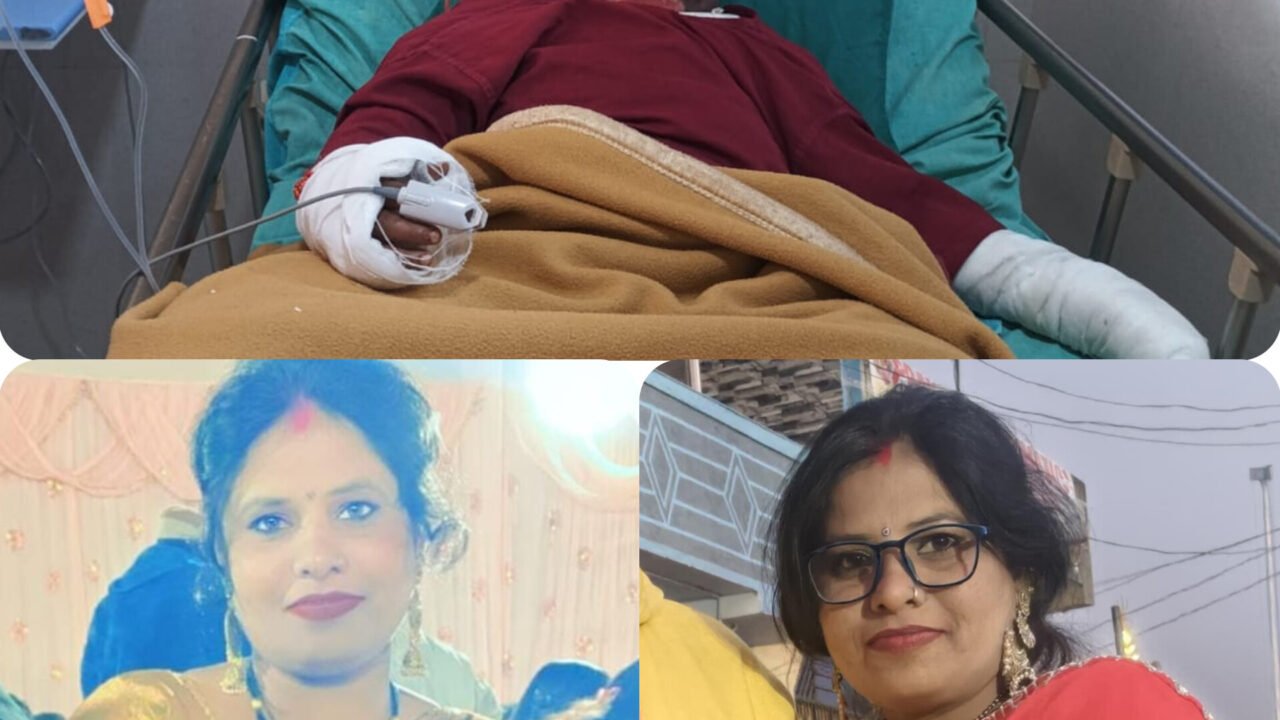 किचन में गैस लीक होने से लगी आग,झुलसी महिला की इलाज के दौरान रांची में मौत